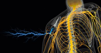 Multimodal Analgesia Pain Management